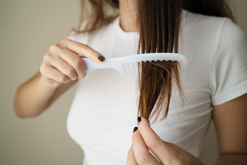 Rimedi naturali per la crescita dei capelli