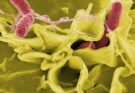Le infezioni più pericolose trasmesse da alimenti