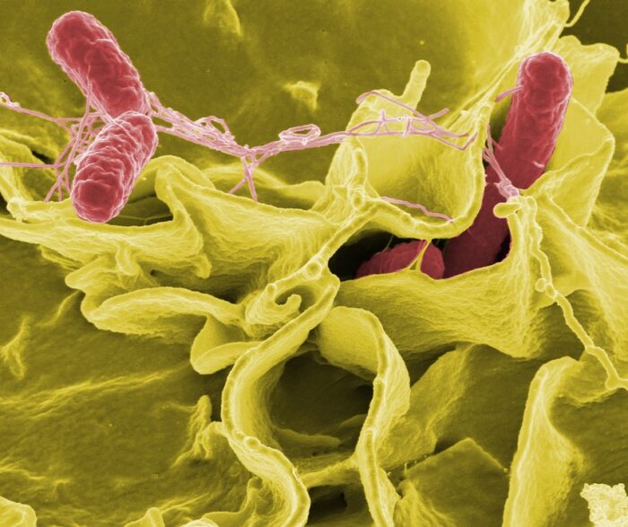 Le infezioni più pericolose trasmesse da alimenti
