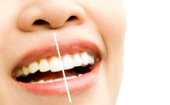 Sbiancare i denti: 4 metodi naturali efficaci