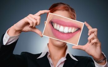 Impianti Dentali: 5 curiosità che non tutti conoscono
