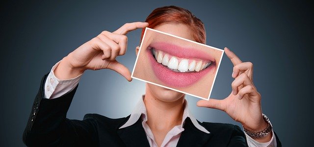 Impianti Dentali: 5 curiosità che non tutti conoscono