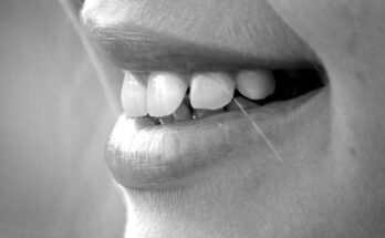 La scienza del sorriso: i tipi e gli effetti dei sorrisi