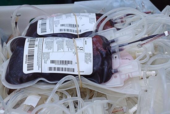 Sacca di sangue tenuta da una mano con guanti medicali, simbolo della donazione di sangue a Napoli.