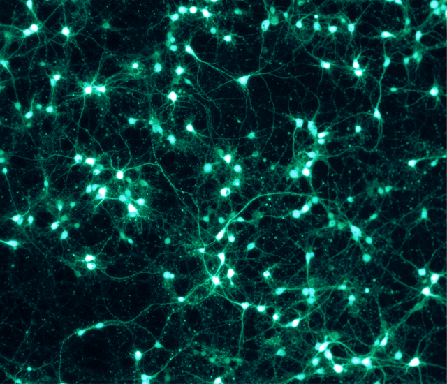 Cosa studiano le Neuroscience