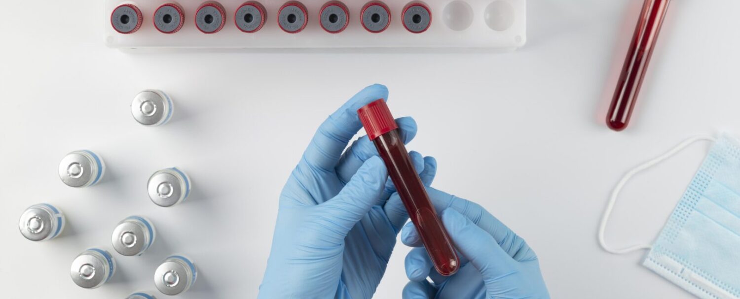 Sangue artificiale universale: la nuova scoperta del Giappone