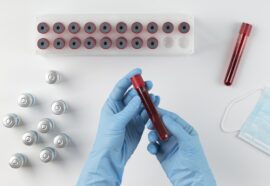 Sangue artificiale universale: la nuova scoperta del Giappone