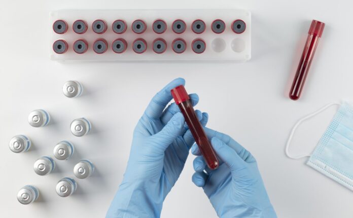 Sangue artificiale universale: la nuova scoperta del Giappone