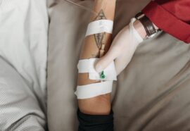 Sifilide in America Latina: epidemia in crescita e dati PAHO